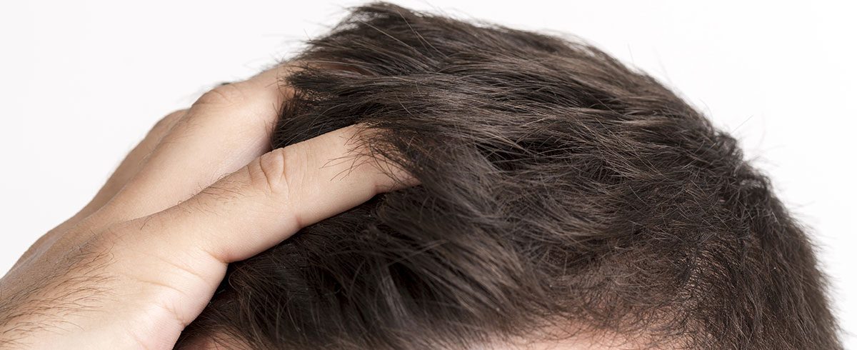 Caduta dei capelli: quali sono i rimedi efficaci?