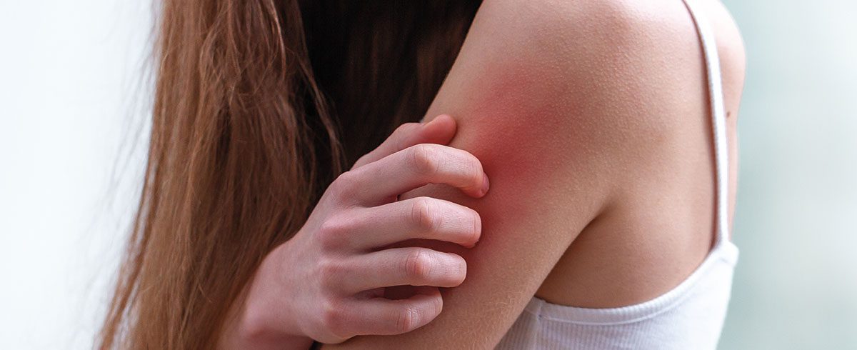 Eczema e dermatite: qual è la differenza?